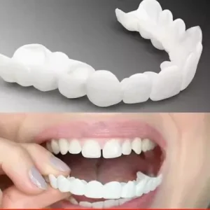 ابتسامة هوليود