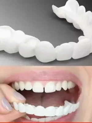 ابتسامة هوليود